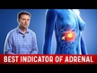 Видео обзор на Dr. Berg, Поддержка надпочечников, Adrenal Glandular, 60 капсул